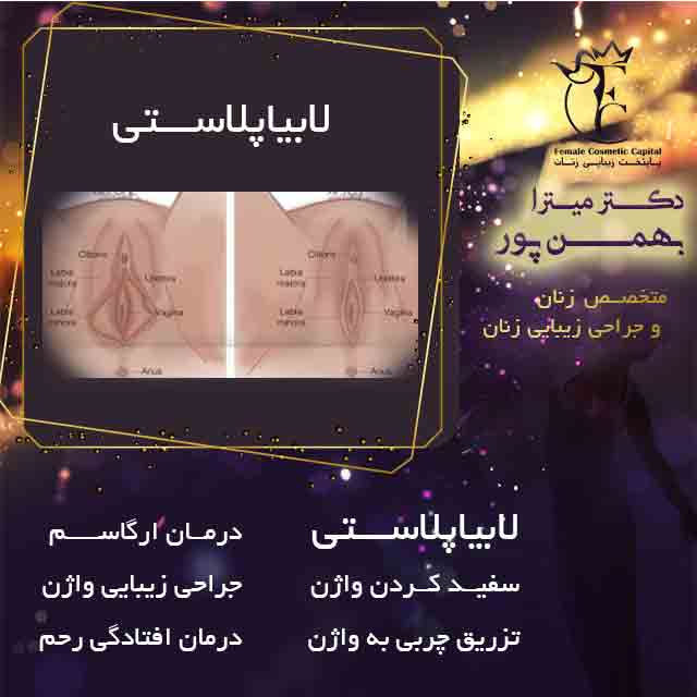 لابیاپلاستی