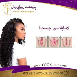 عمل لابیاپلاستی چیست