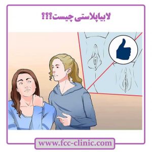 لابیا چیست و علت جراحی لابیاپلاستی چیست