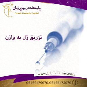 تزریق ژل به واژن