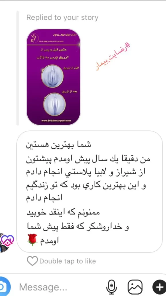 تجربه لابیاپلاستی 141