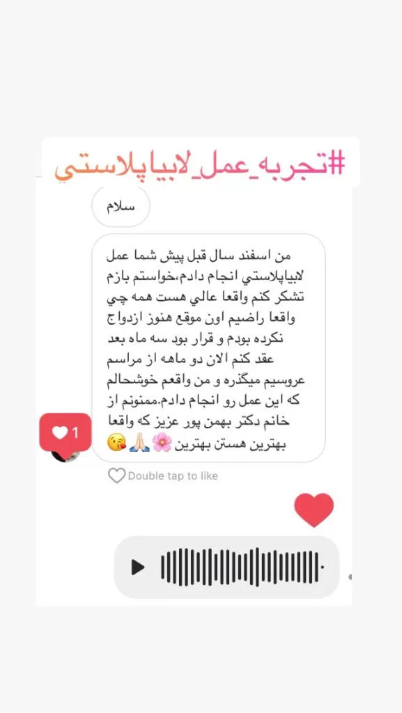 تجربه لابیاپلاستی 181