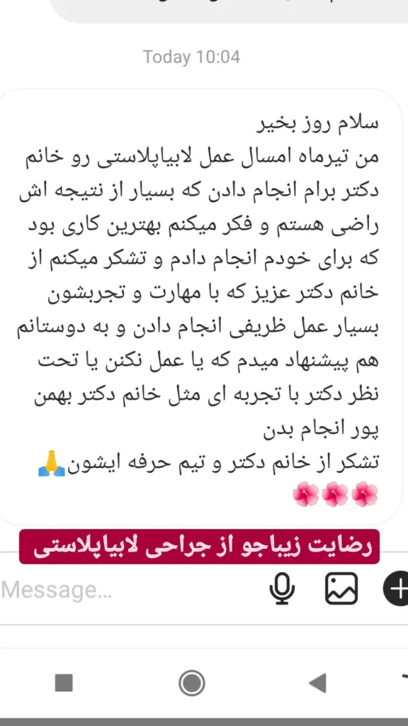 تجربه لابیاپلاستی 41