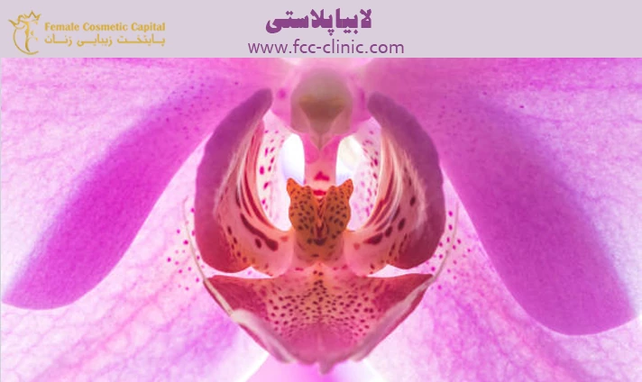 لابیاپلاستی لابیاپلاستی