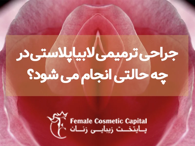 ترمیم لابیاها
